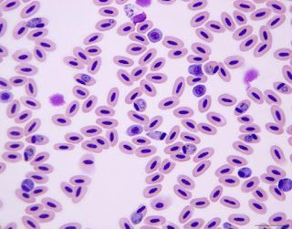 Avian Malaria: ภัยเงียบในฟาร์มสัตว์ปีกที่ไม่ควรมองข้าม
